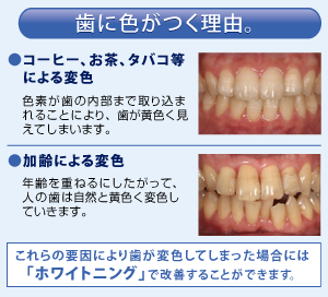 着色の理由