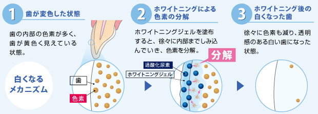 ホワイトニングの効果